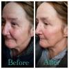 Instantly Ageless - Jeunesse Global offer skin-care