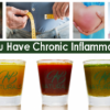 Rid yourself from Inflammation 30 day Money Back Guarantee offer health